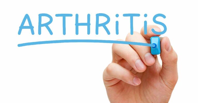 Managing Arthritis: A Holistic Approach to Relief